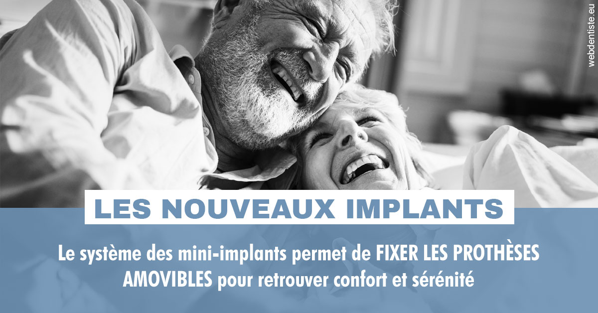 https://selarl-heraud.chirurgiens-dentistes.fr/Les nouveaux implants 2