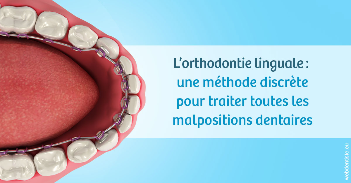 https://selarl-heraud.chirurgiens-dentistes.fr/L'orthodontie linguale 1