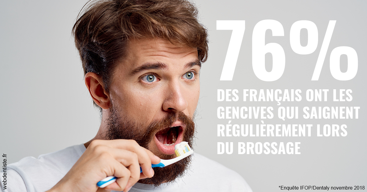 https://selarl-heraud.chirurgiens-dentistes.fr/76% des Français 2