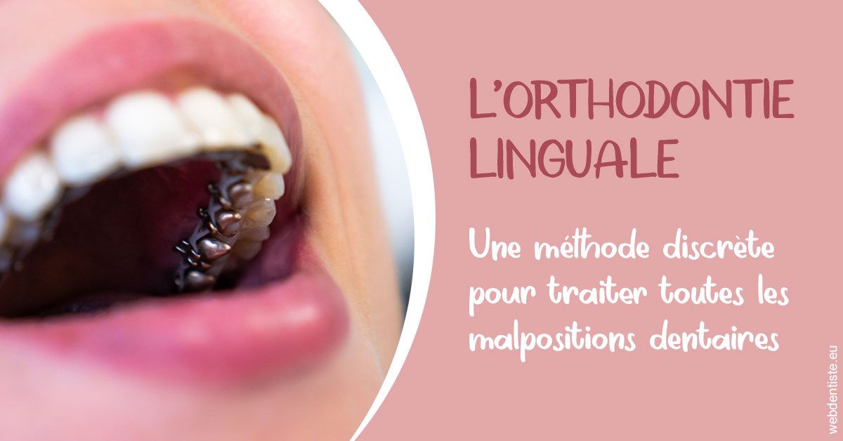 https://selarl-heraud.chirurgiens-dentistes.fr/L'orthodontie linguale 2