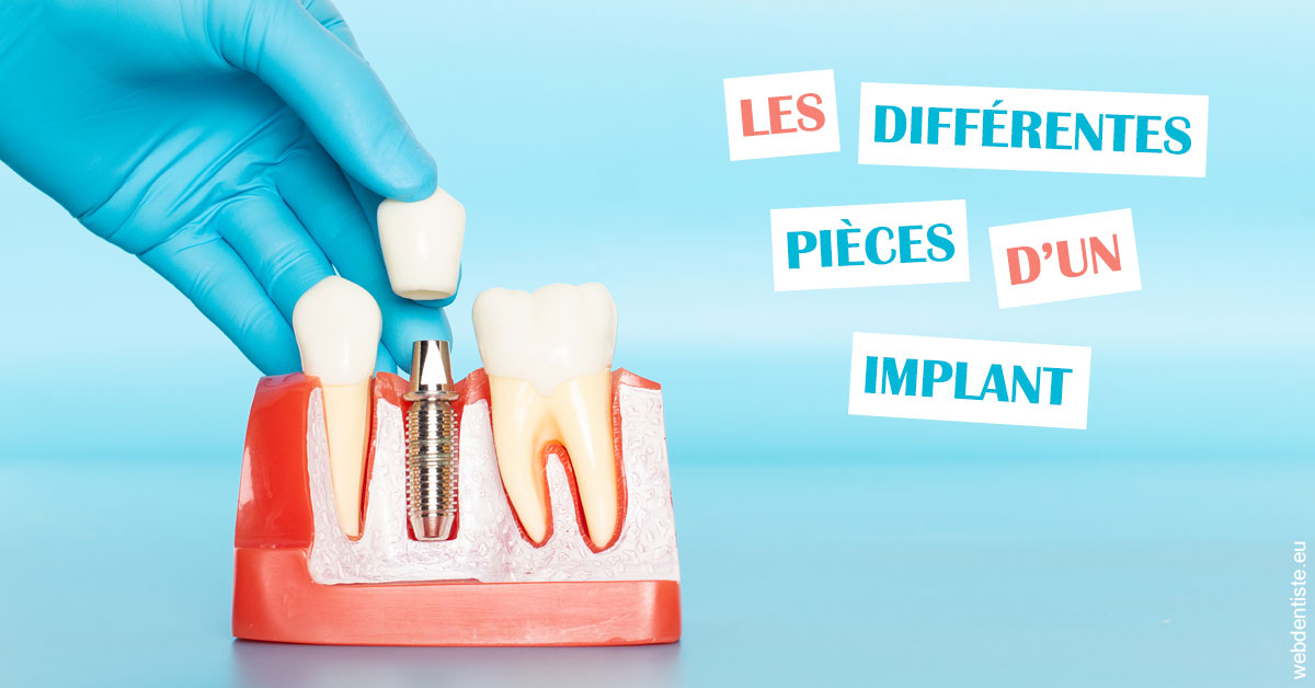 https://selarl-heraud.chirurgiens-dentistes.fr/Les différentes pièces d’un implant 2