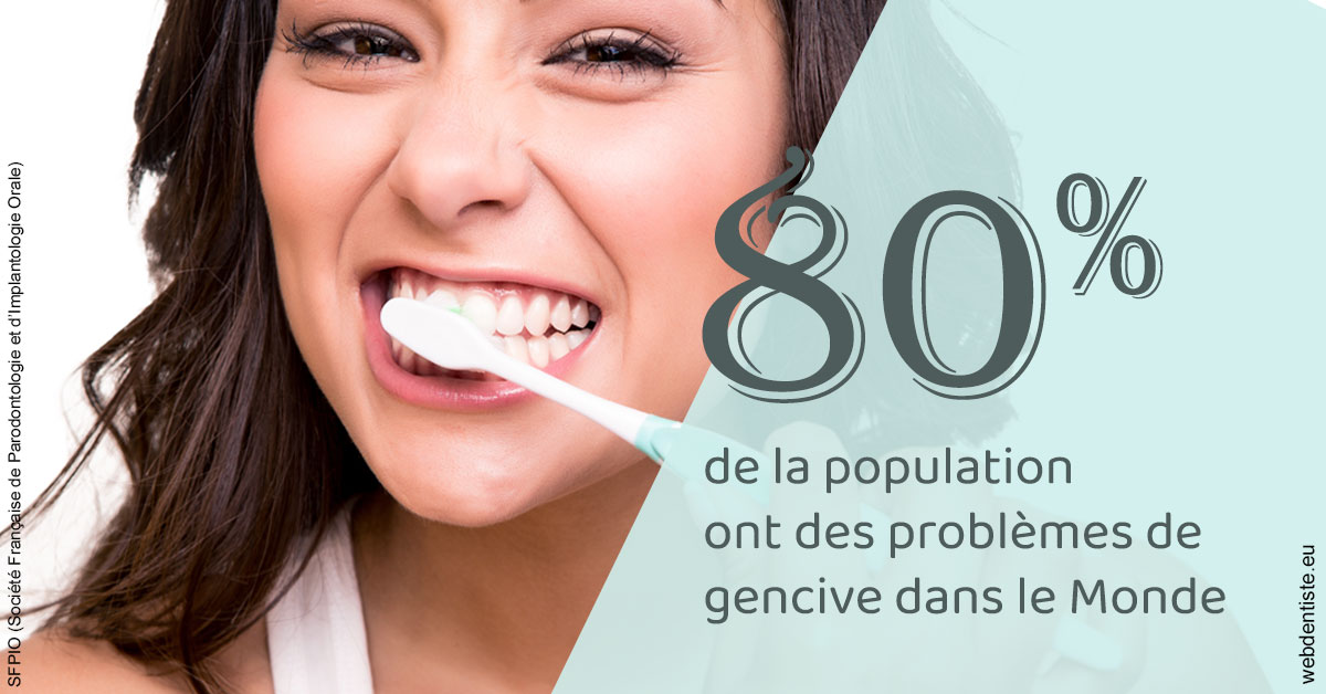https://selarl-heraud.chirurgiens-dentistes.fr/Problèmes de gencive 1