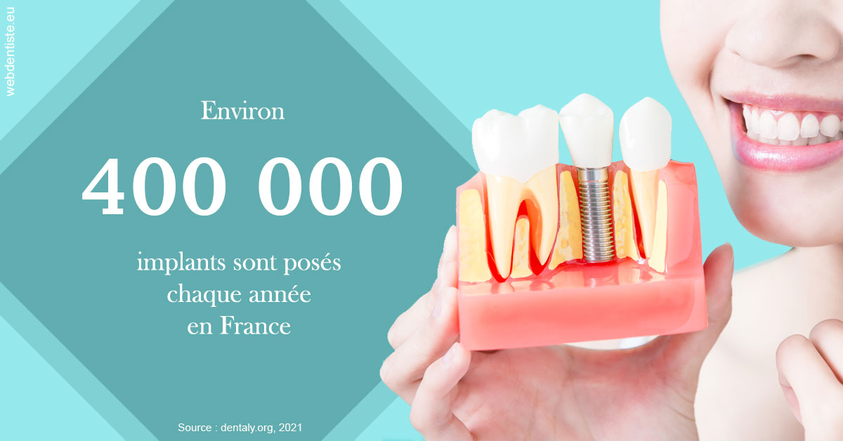 https://selarl-heraud.chirurgiens-dentistes.fr/Pose d'implants en France 2